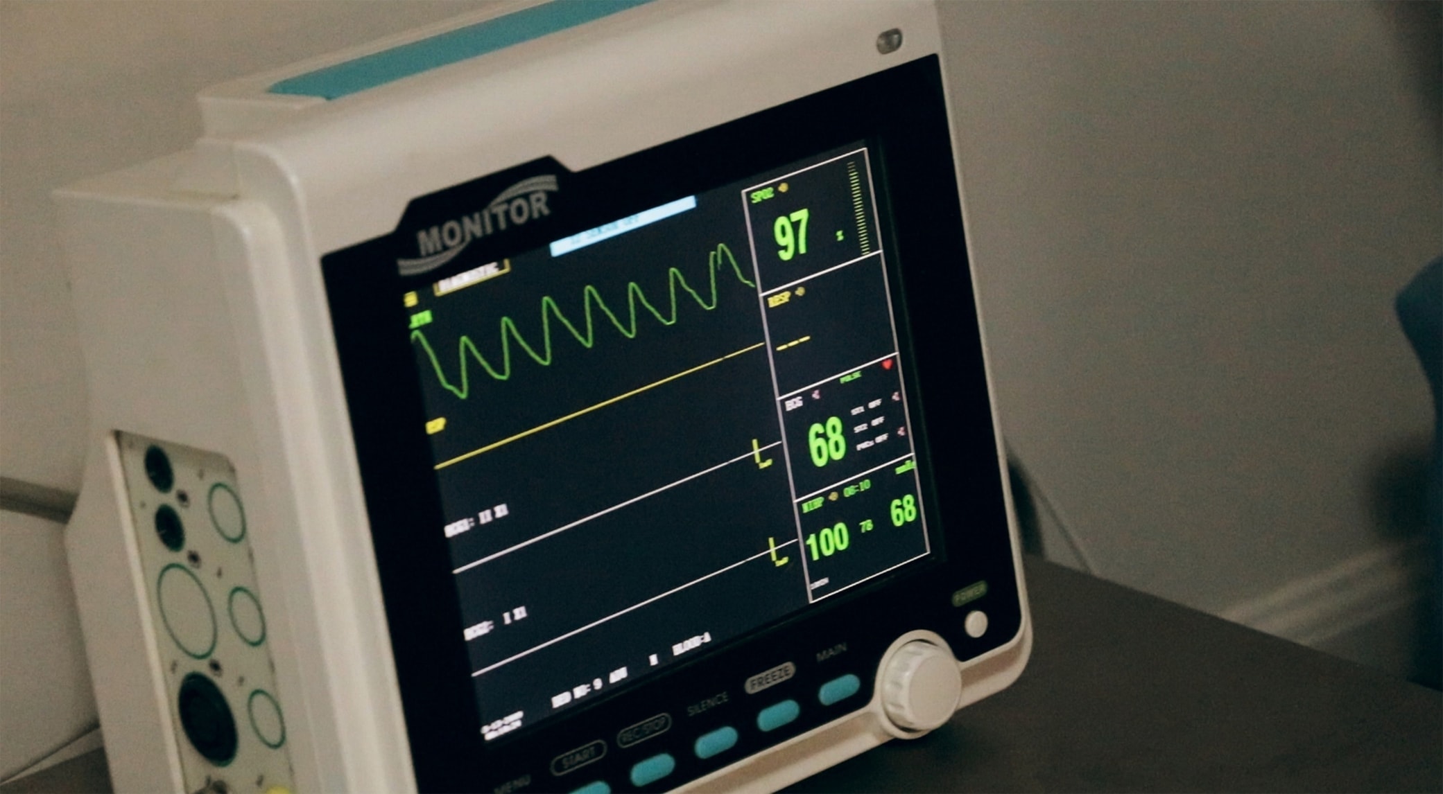 a picture of an EKG machine